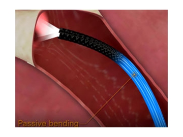 H-steriScopeTM | Broncoscopio desechable, tipo especialmente largo